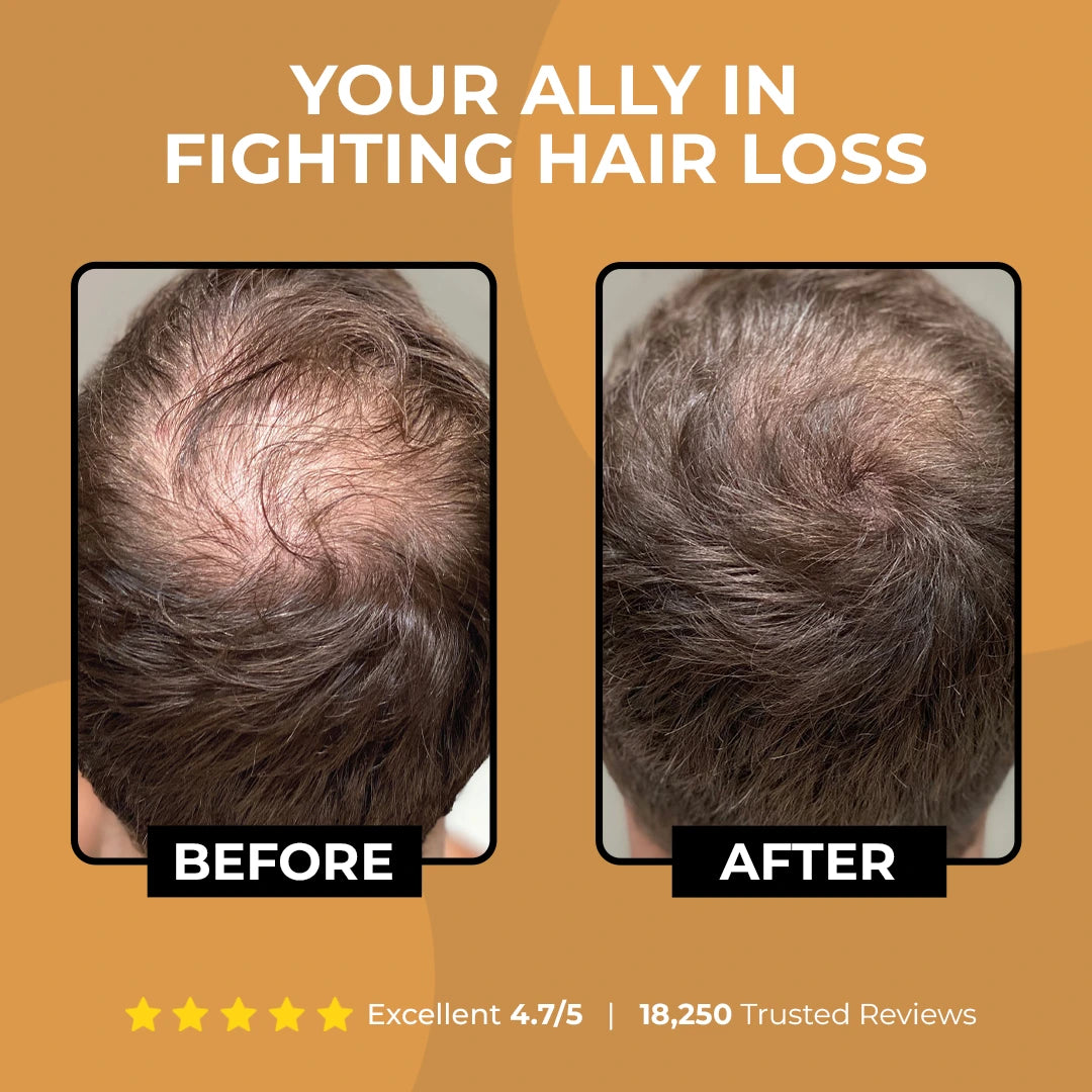 Root Activator Shampoo
