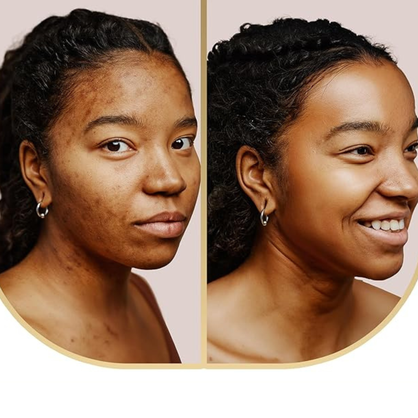 Intensive Cleansing Bar Soap
