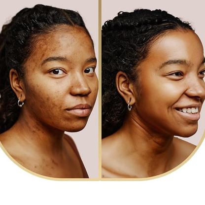 Intensive Cleansing Bar Soap