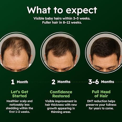 Hair Regrowth System