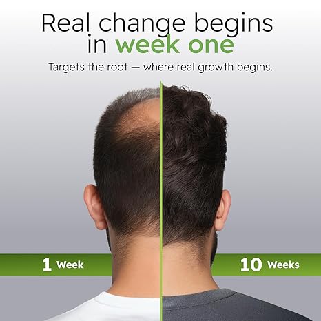 Hair Regrowth System