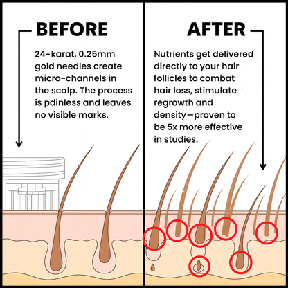 Hair Regrowth System - Scalp Stamping Ritual
