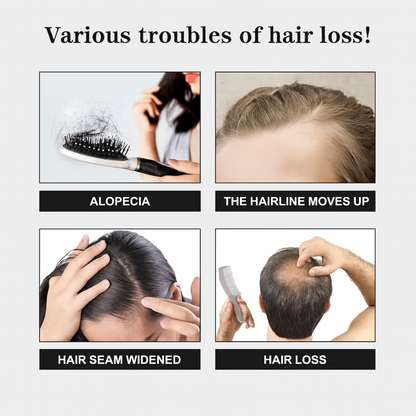 Hair Regrowth System - Scalp Stamping Ritual
