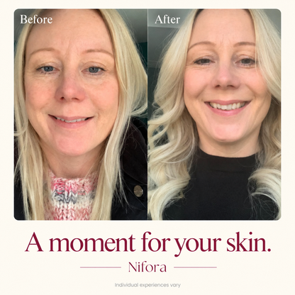 Nifora source customer comparison; individual experiences vary